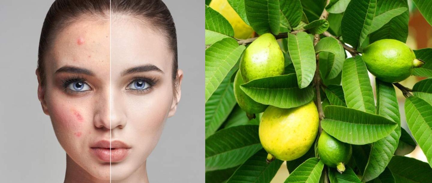 स्किन के लिए अमरूद की पत्तियों के फायदे और उपयोग, Guava Leaves skin Benefits and how to apply DIY in Hindi