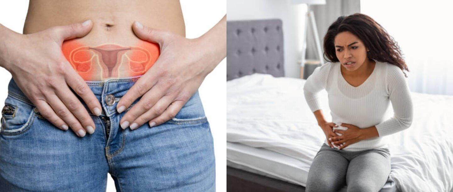 Ovarian Cyst in Hindi | ओवेरियन सिस्ट के लक्षण और उपचार