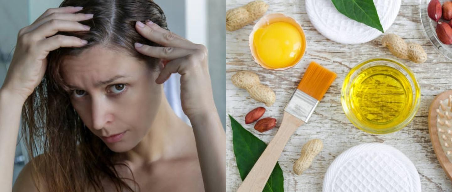 Hair Care, Dry Scalp cure, Home remedies for dry scalp