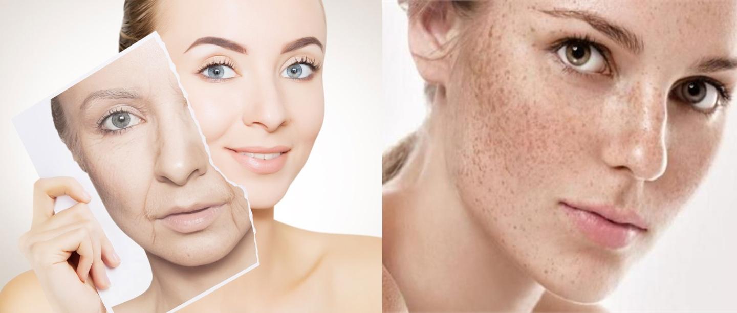 Home remedies to remove wrinkles and freckles from face, wrinkles and freckles, चेहरे से झुर्रियां और झाइयां दूर करने के उपाय
