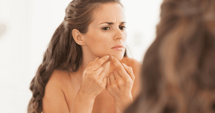 अपने चेहरे से पिम्पल्स को ओवरनाइट गायब करें इन शॉर्टकट्स की मदद से! &#8211; How to Get Rid of Pimples Overnight in Hindi