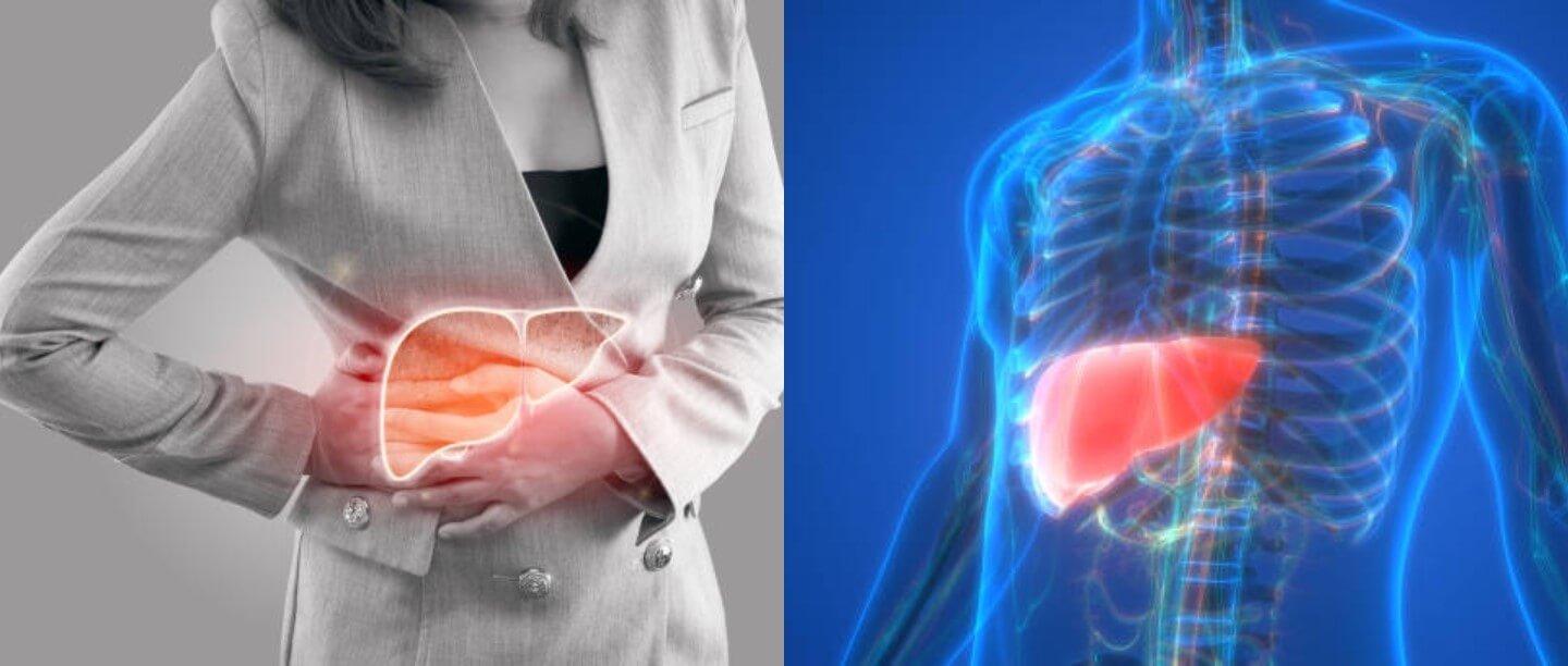 Fatty Liver Symptoms & Treatment in Hindi - fatty liver ke lakshan aur upay