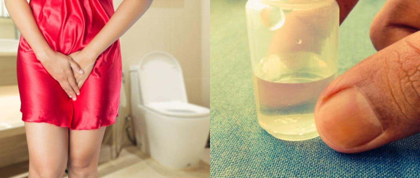 यूरिन इन्फेक्शन के लक्षण, कारण और घरेलू उपाय - Home Remedies for Urine Infection in Hindi