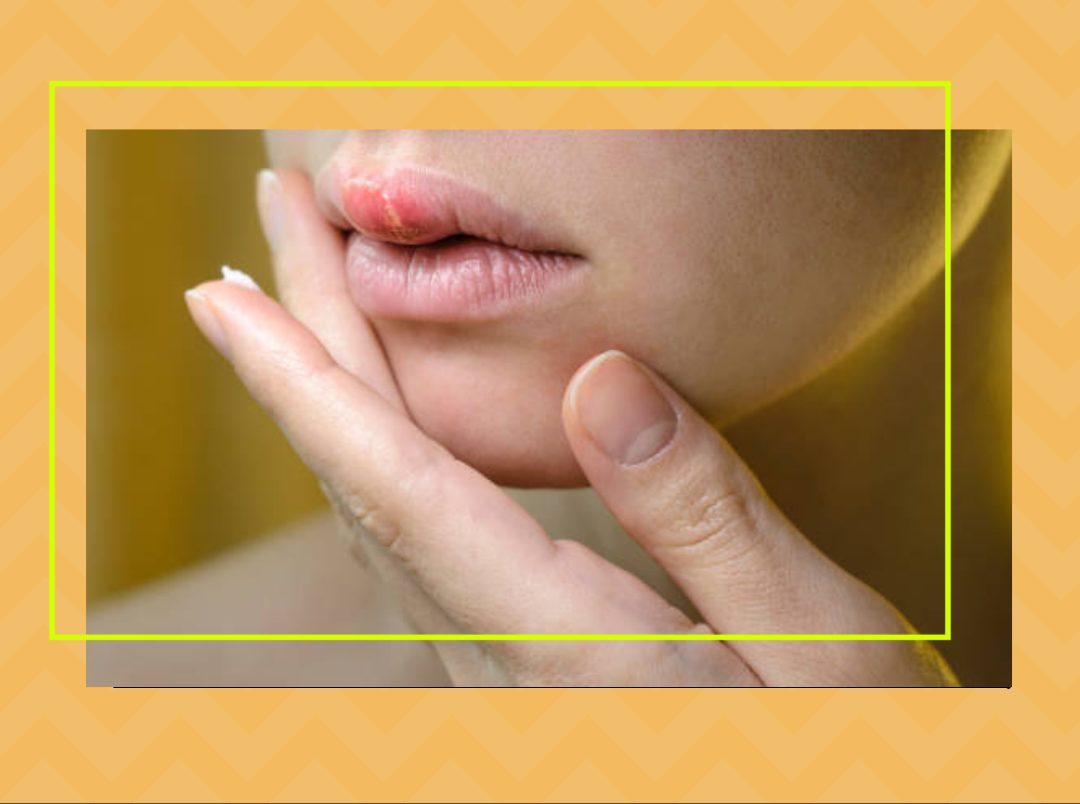 Lips Infection Treatment